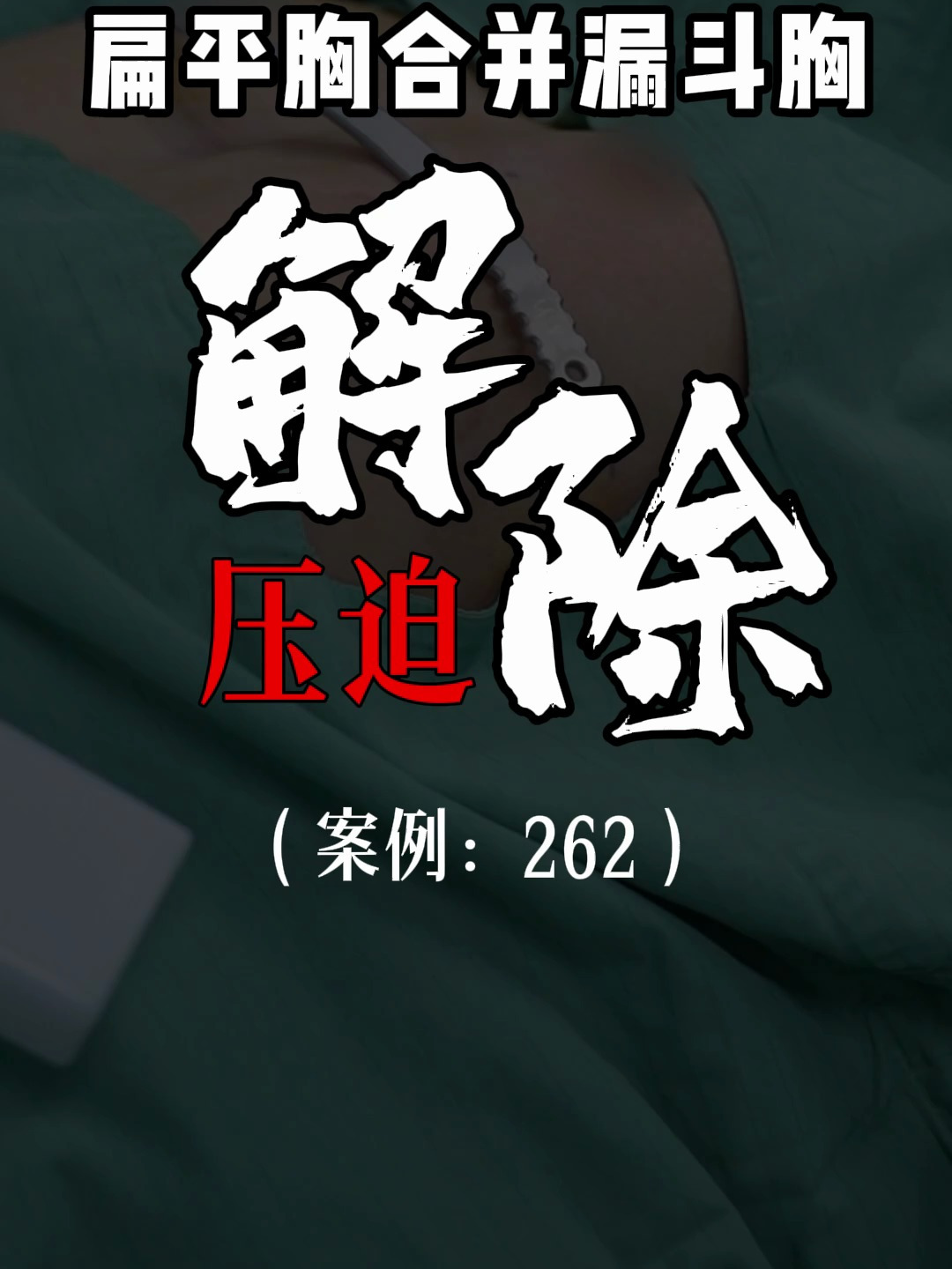 漏斗胸鸡胸医生张东升