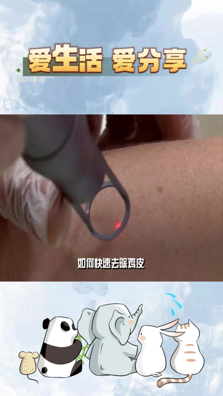 激光治疗鸡皮肤,效果如何?