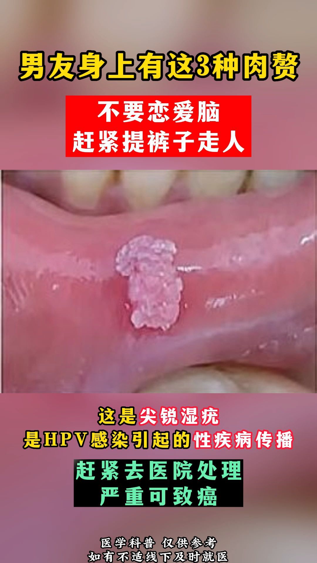 男友身上有这3种肉赘不要恋爱脑