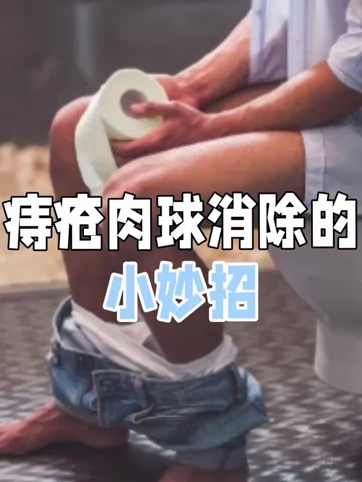 痔疮肉球消除的小妙招,总有一个适合你!