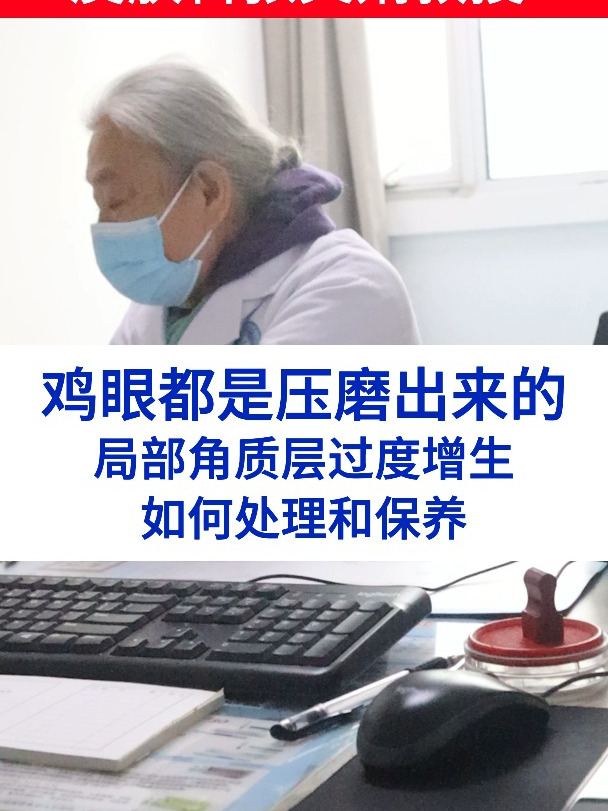 鸡眼都是长期站立走路磨出来的