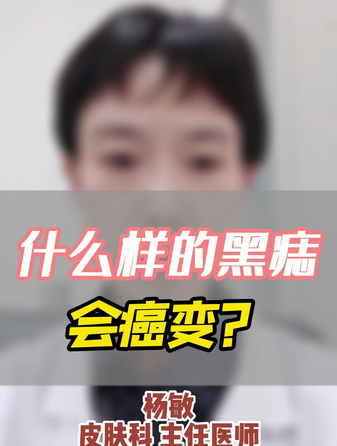 什么样的黑痣会癌变?