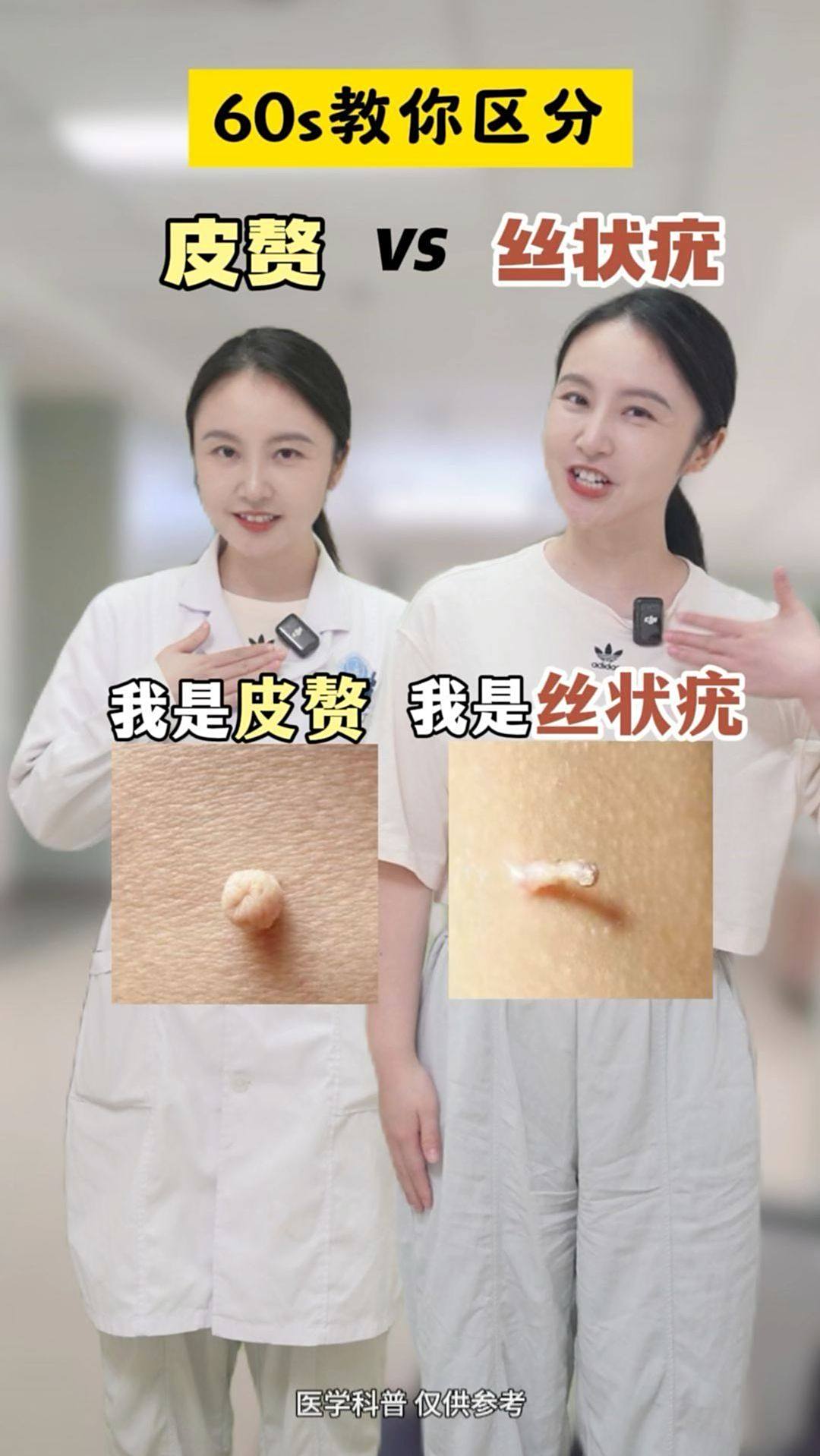 脖子上的小肉粒到底是什么,一条视频教你区分处理