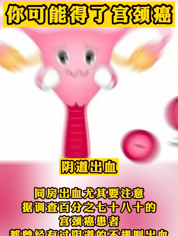 警惕这些症状,你可能得了宫颈癌