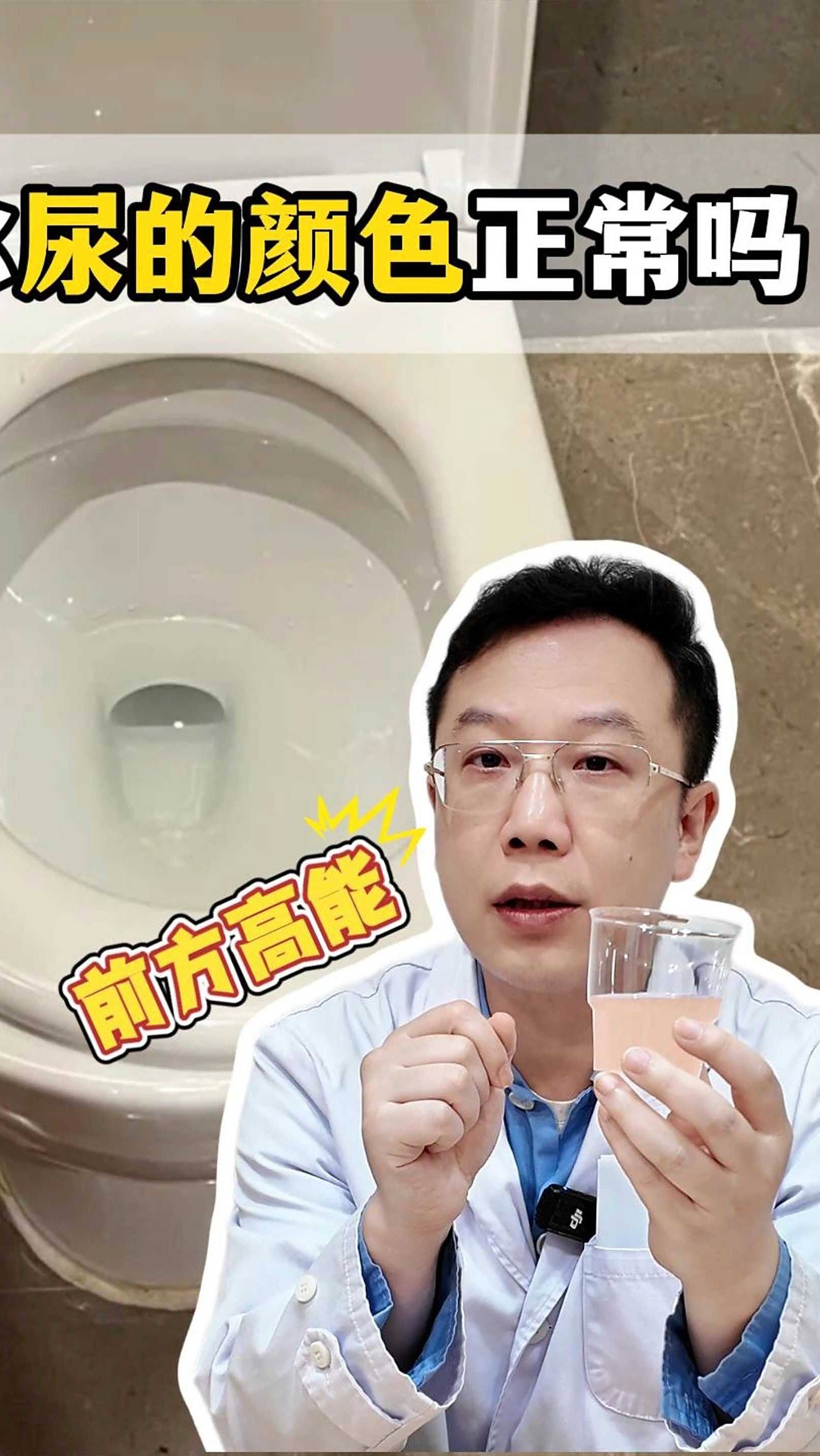 你尿的颜色正常吗