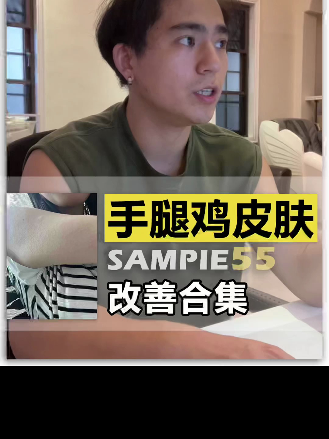 50天的变化,手臂和腿部的鸡皮肤,主要是疙瘩及引起的一个发红