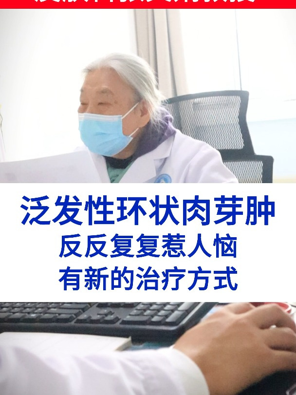 环状肉芽肿怎么才能不反复
