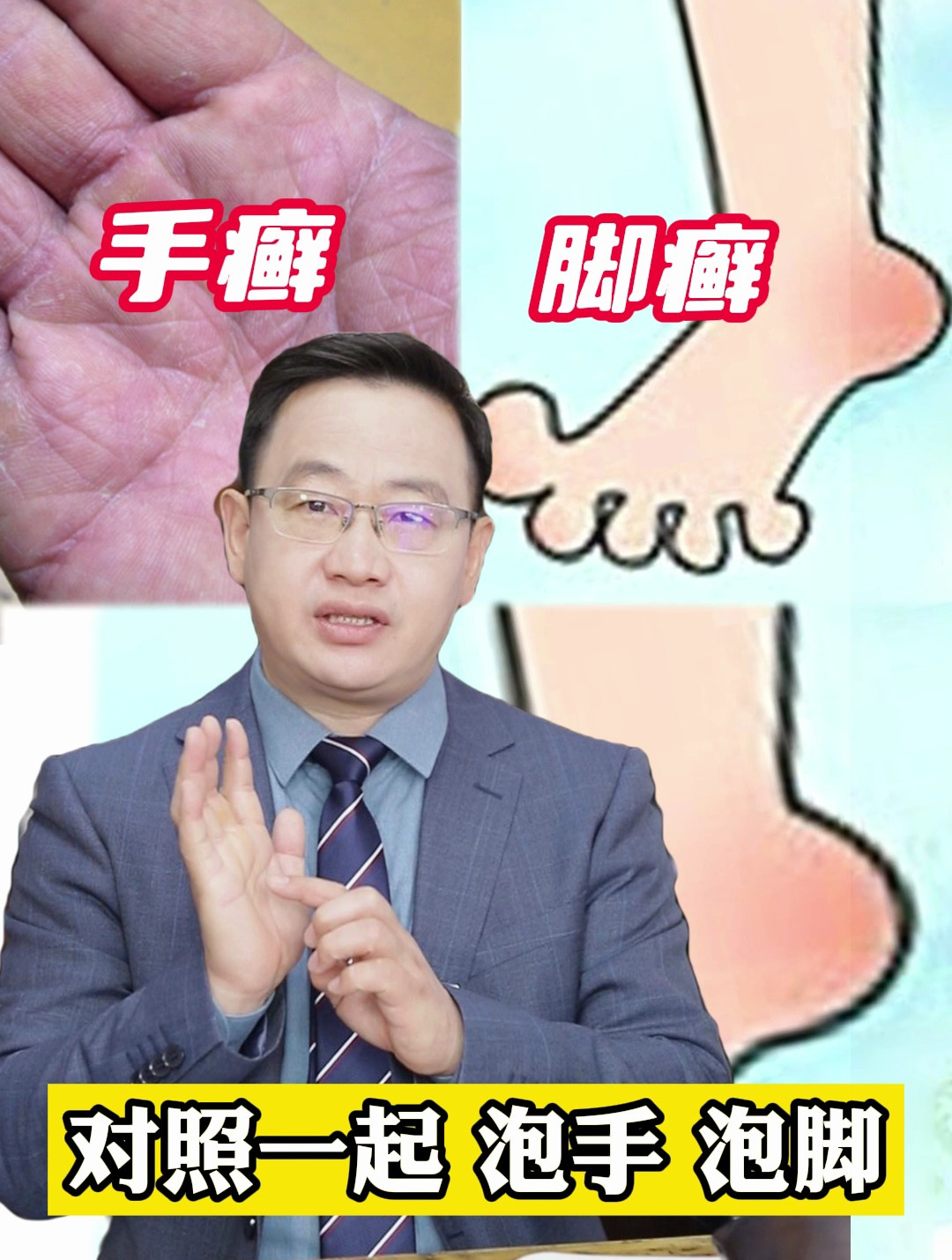手癣、脚癣,中药泡手泡脚