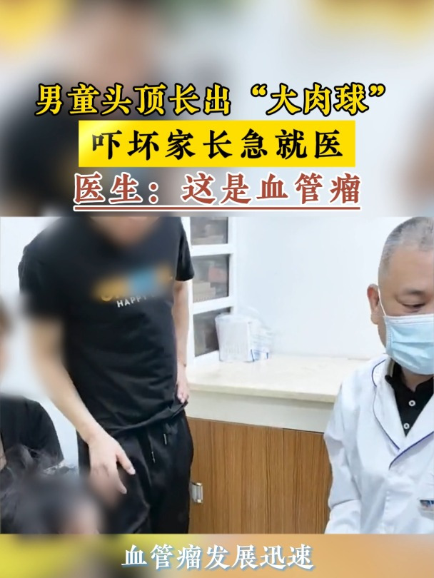 案例12男童头顶长出“大肉球”吓坏家长急就医医生:这是血管瘤