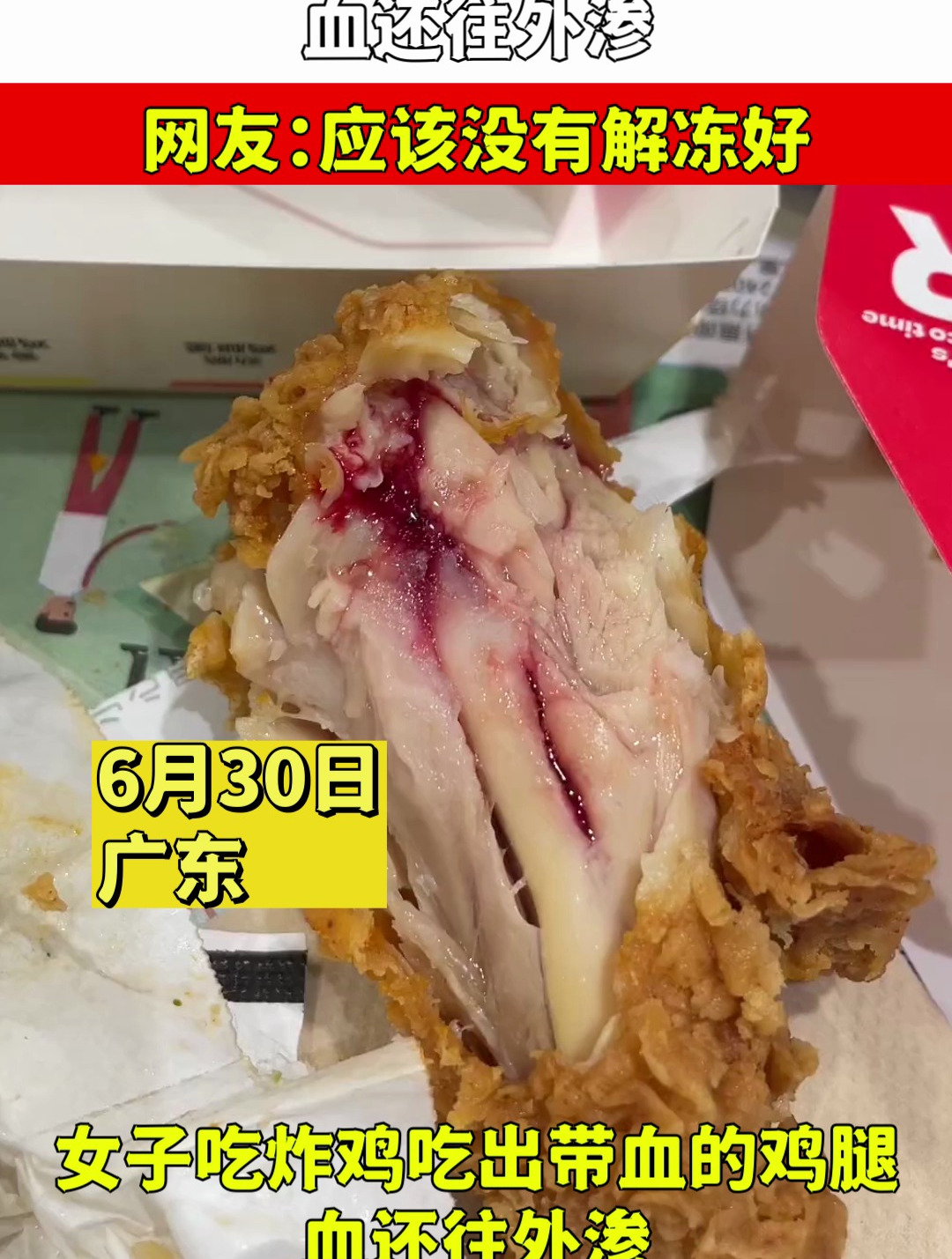 女子吃炸鸡吃出带血的鸡腿,血还往外渗,网友:应该没有解冻好