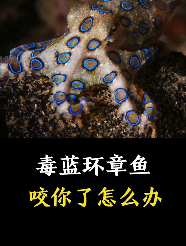 毒蓝环章鱼,咬你了,怎么办?