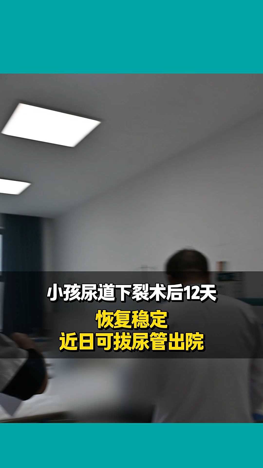 小孩尿道下裂术后12天恢复稳定,近日可拔尿管出院