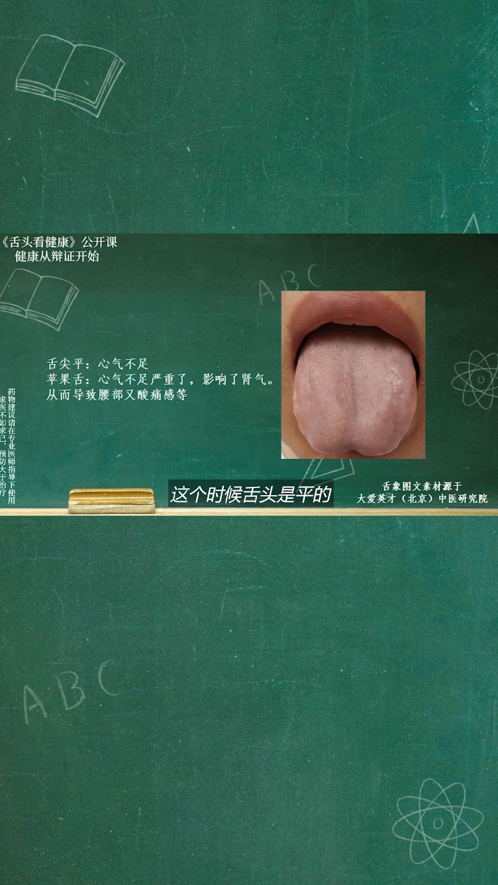 舌象分析:舌尖有塌陷,舌根部凸起提示体内心血不足,心肾不交