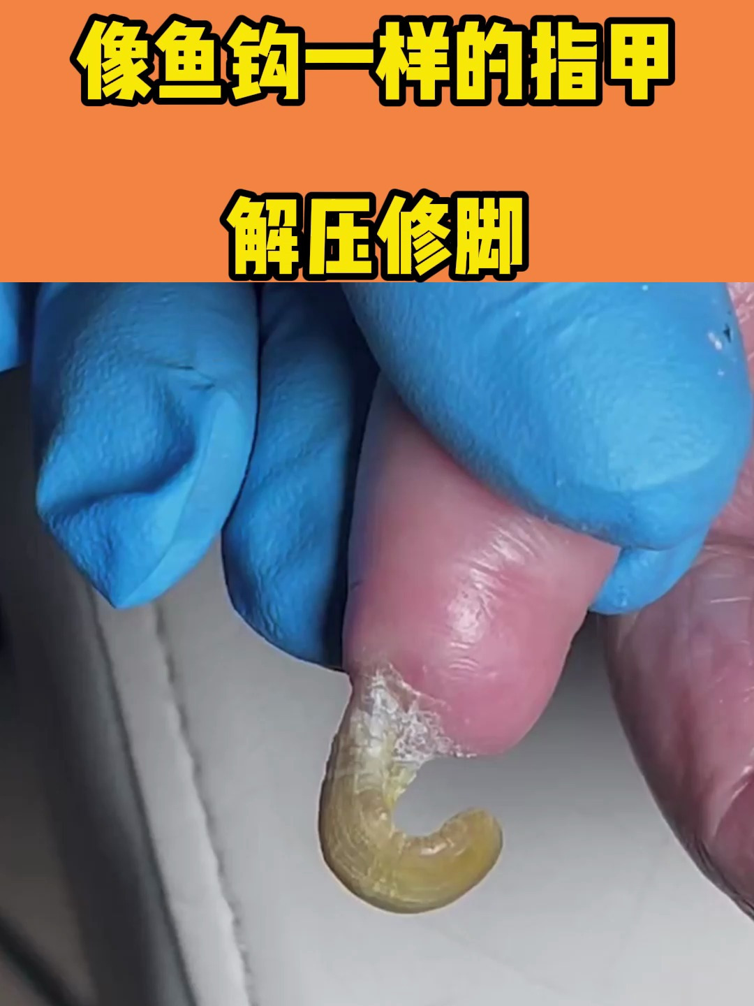 像鱼钩一样的指甲,剪下来能钓鱼了