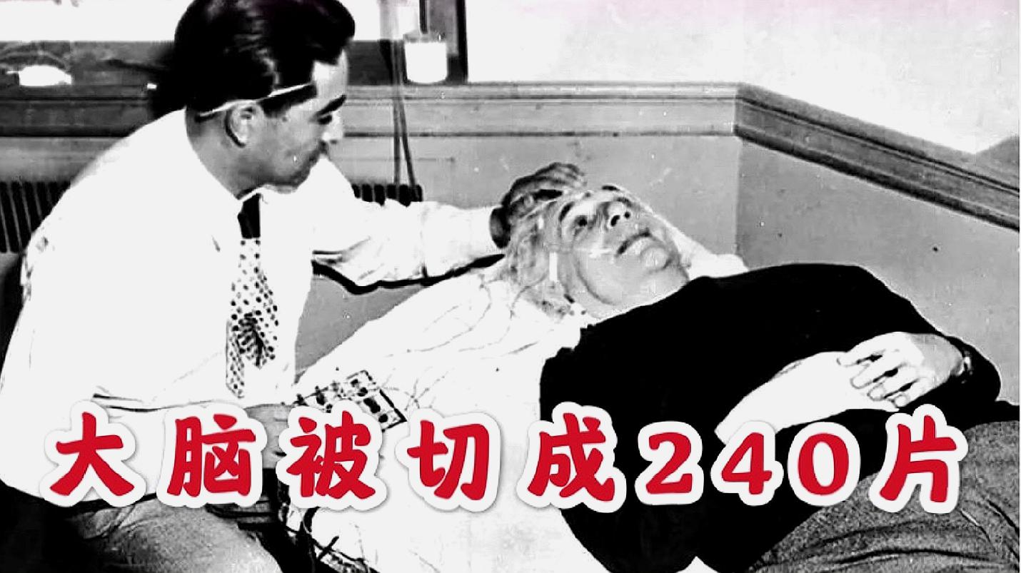 [图]爱因斯坦死前说了两句话,医生听不懂,死后大脑被切成240片!