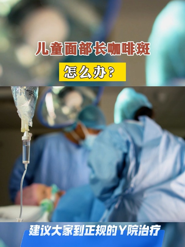 儿童面部长咖啡斑,怎么办?