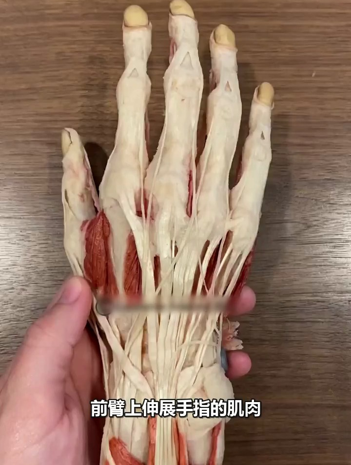 人体标本科普,手上的肌肉是附着在手掌上的!