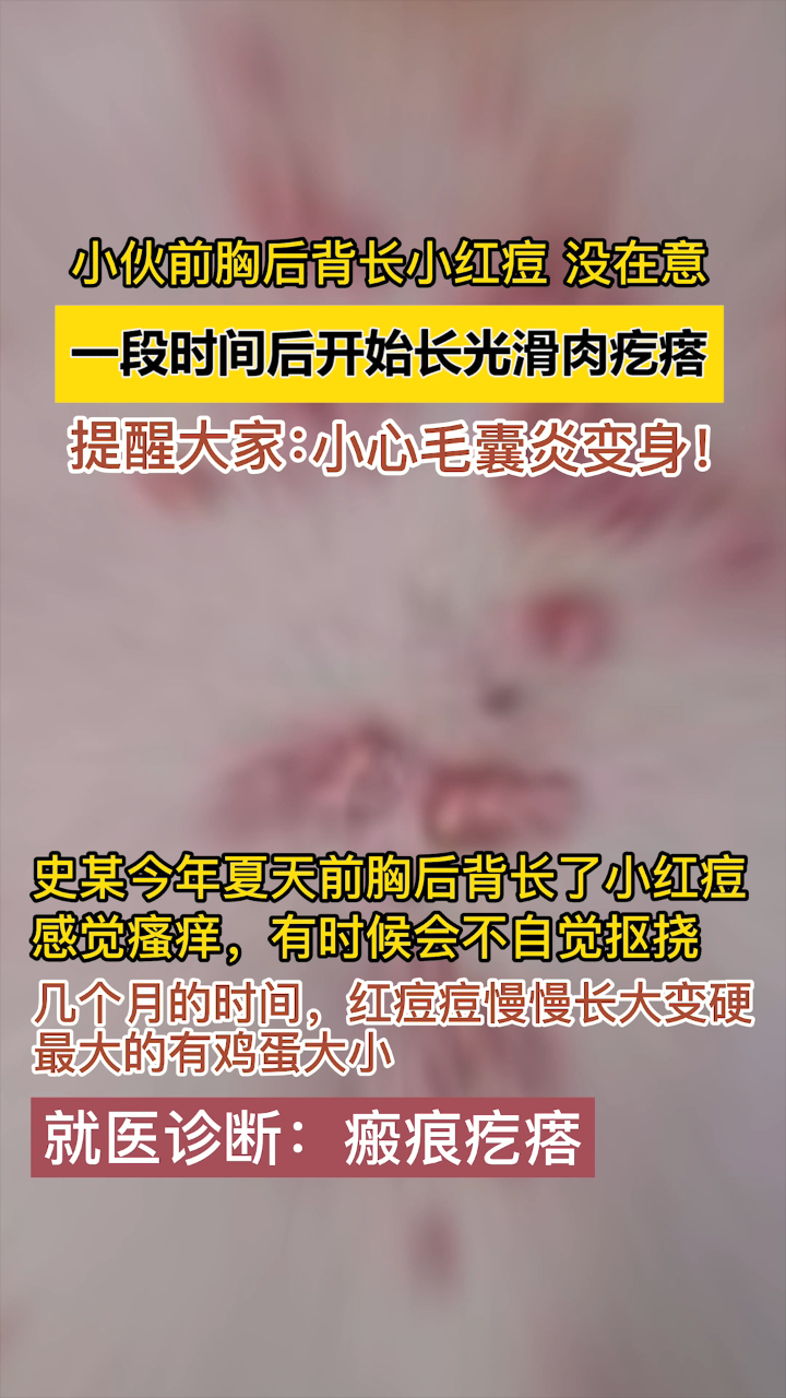 瘢痕体质的朋友注意了!