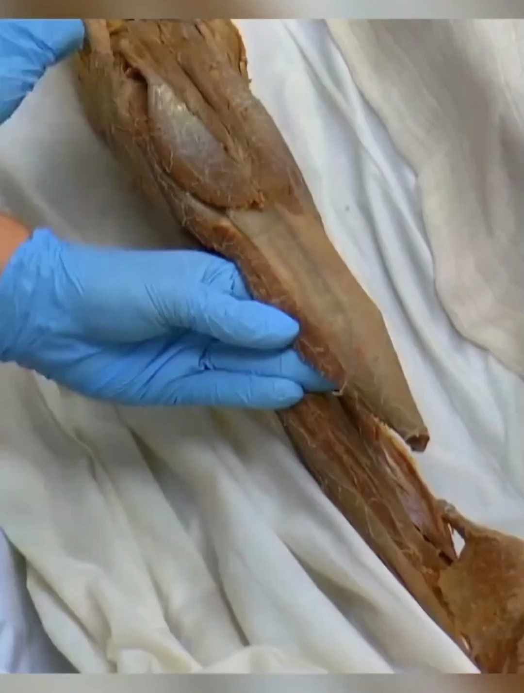 小腿肌肉是怎么运动的?