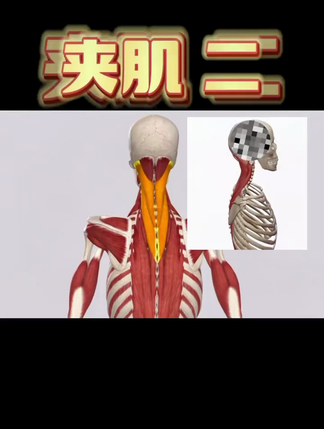 夹肌——颈肩部重要的一组肌肉