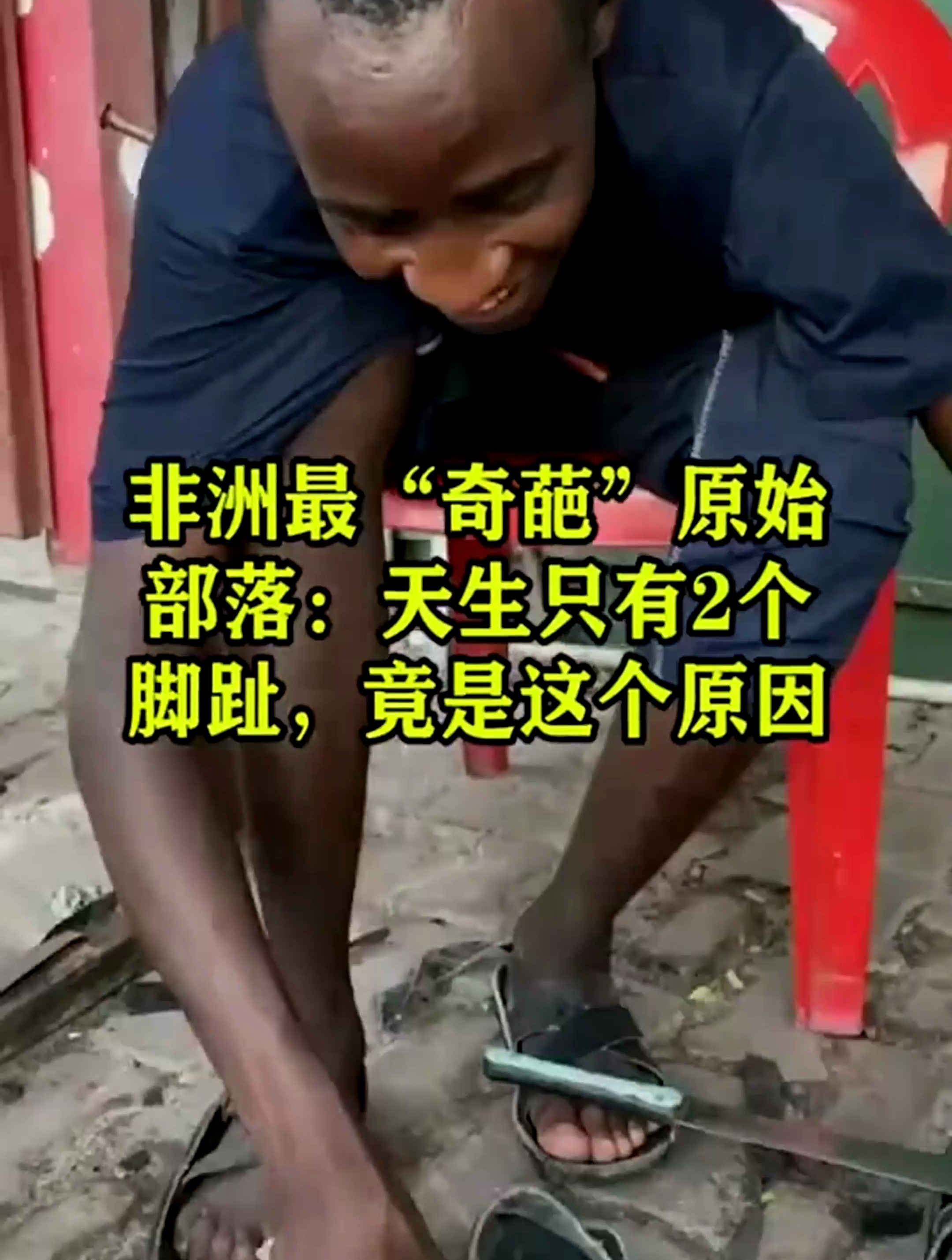 非洲最“奇葩”原始部落,天生只有2个脚趾,竟是这个原因