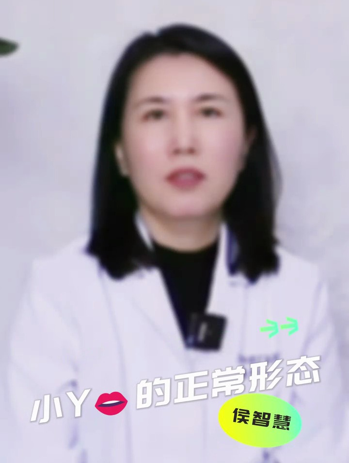 女性小阴唇的正常形态是什么样