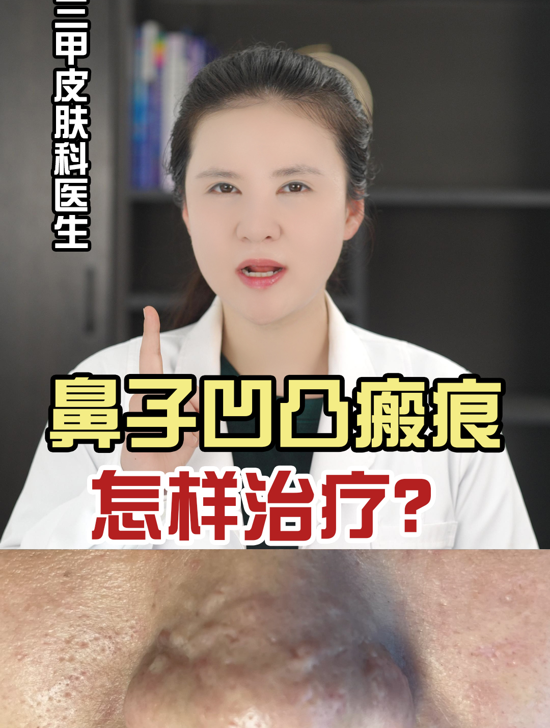 鼻子上凹凸不平的瘢痕怎么办?