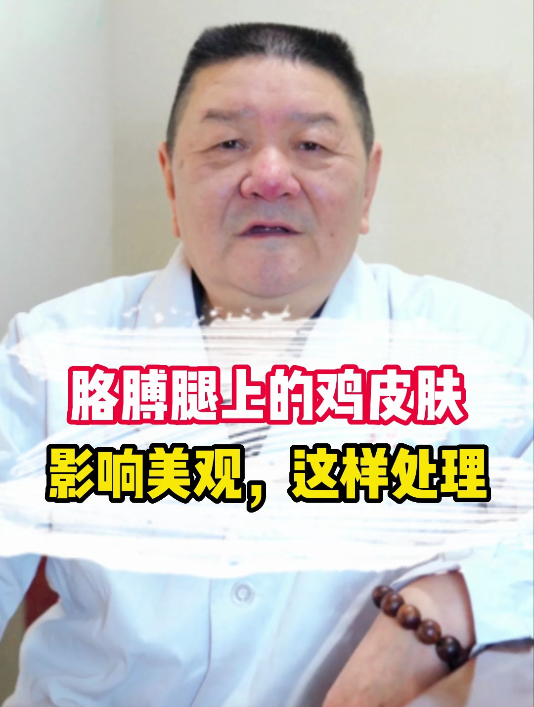 胳膊腿上的鸡皮肤,影响美观,试试这样处理