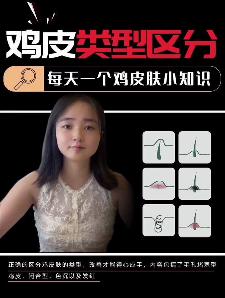 鸡皮肤的类型区分