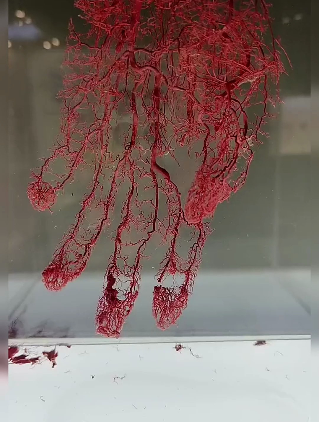 人类的手部血管分布