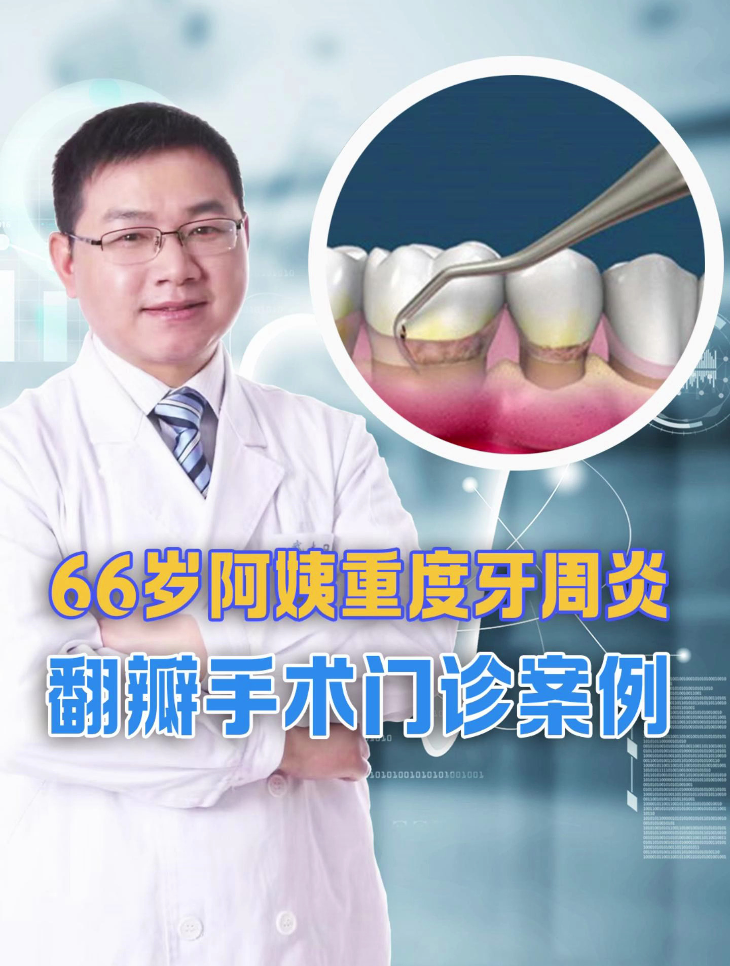 翻瓣手术门诊手术案例