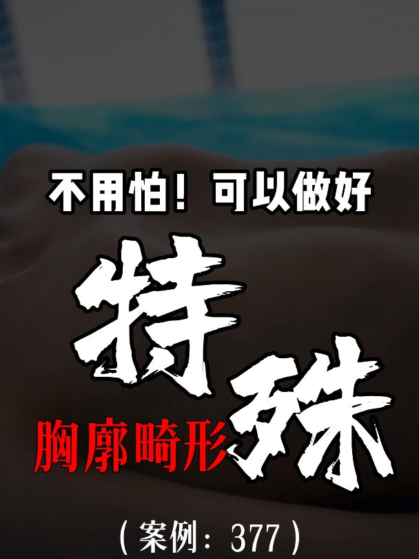 漏斗胸鸡胸医生张东升