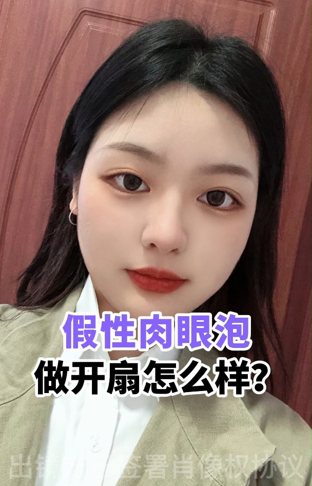 假性肉眼泡,做哪种双眼皮?建议开扇型哦~
