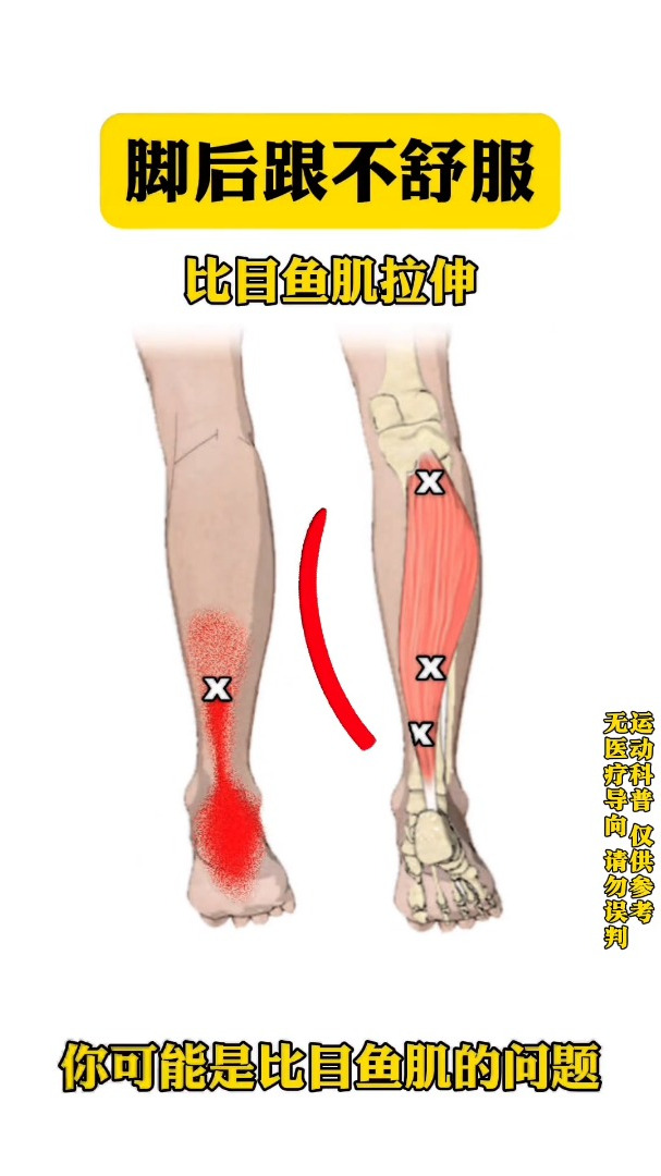 脚后跟不舒服做一下比目鱼肌拉伸