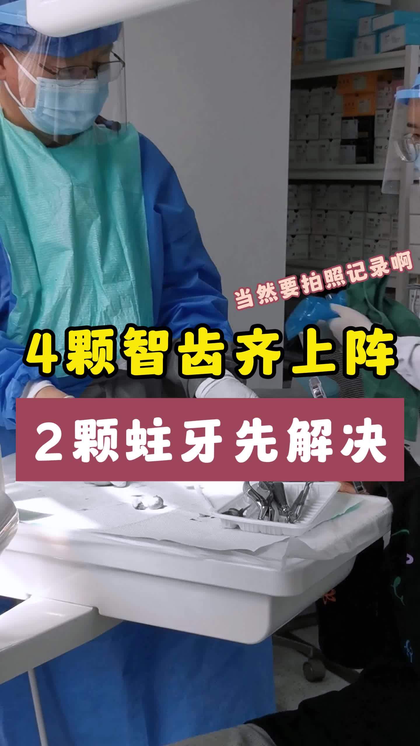 4颗智齿齐上阵,2颗蛀牙先解决!