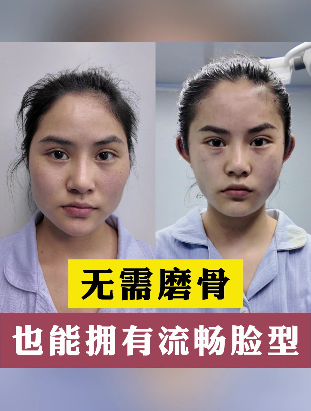 “鸭梨”脸不动骨,调整鹅蛋脸效果也太惊艳了吧!