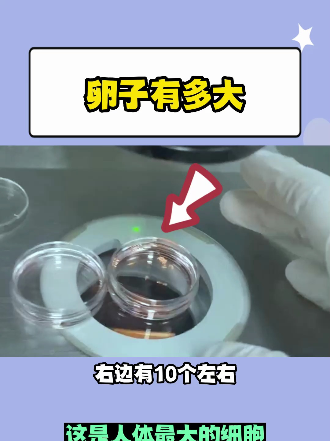 曲丹妮-震惊!卵子竟然肉眼可见