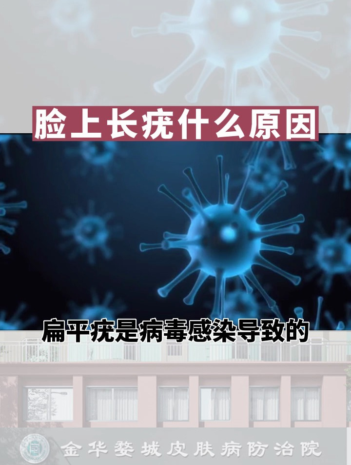 脸上长疣什么原因