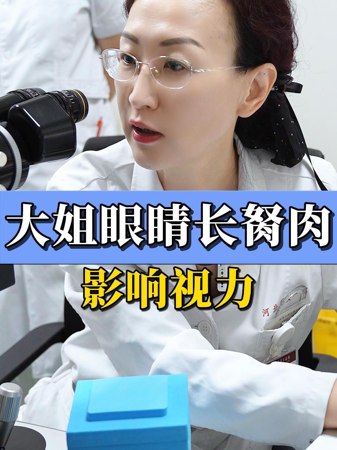 大姐眼睛长胬肉,影响视力