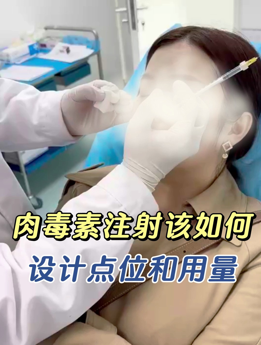 肉毒素注射该如何设计点位和用量