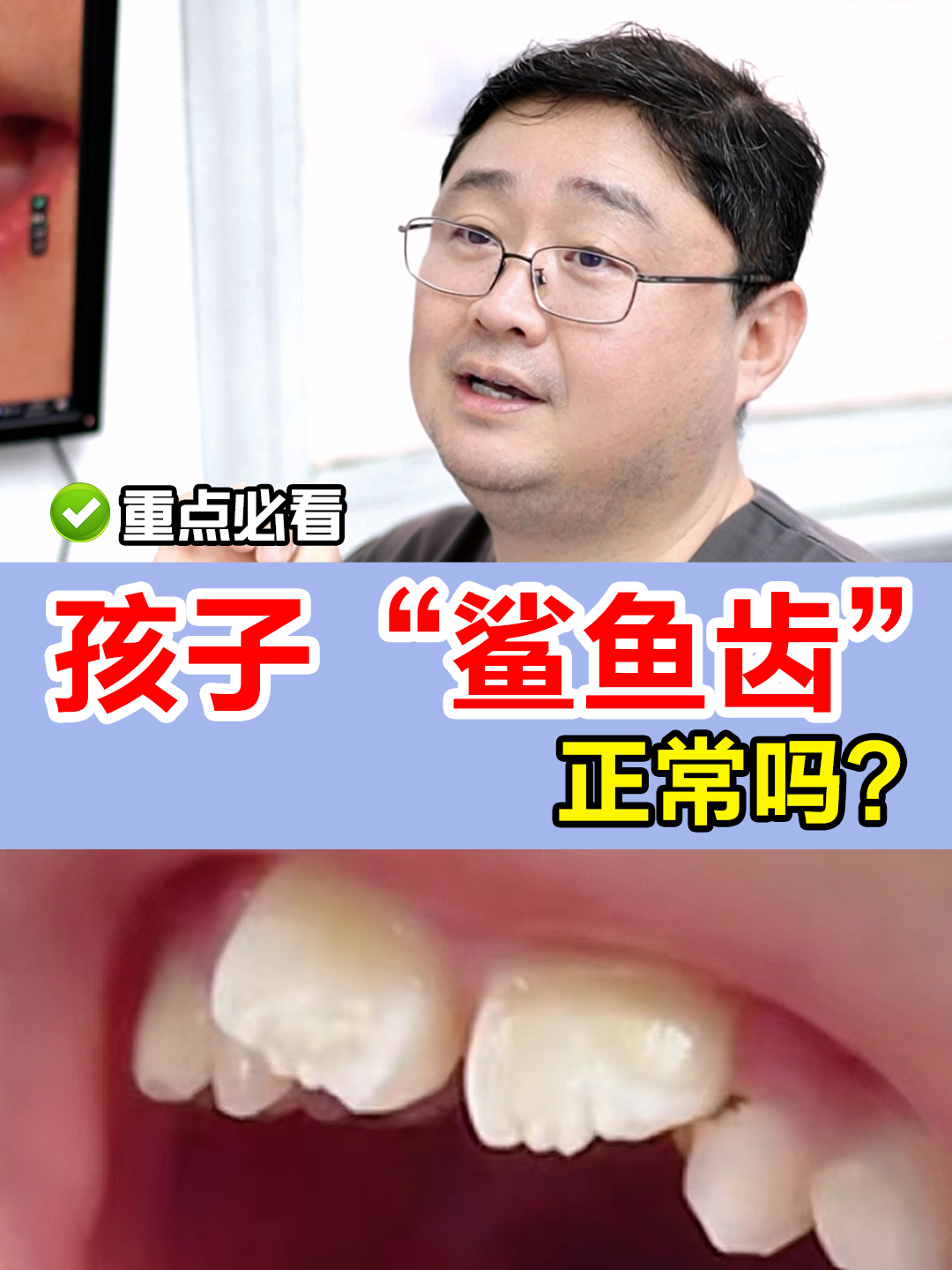 孩子牙齿像鲨鱼,正常吗?