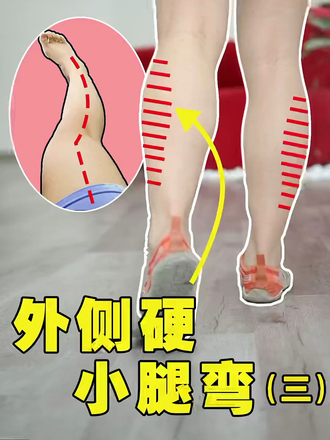 这个视频可以帮助你平衡小腿后侧肌肉,改善外扩