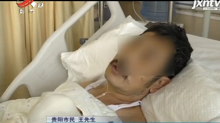 贵州贵阳:洗鱼扎破手 住进ICU
