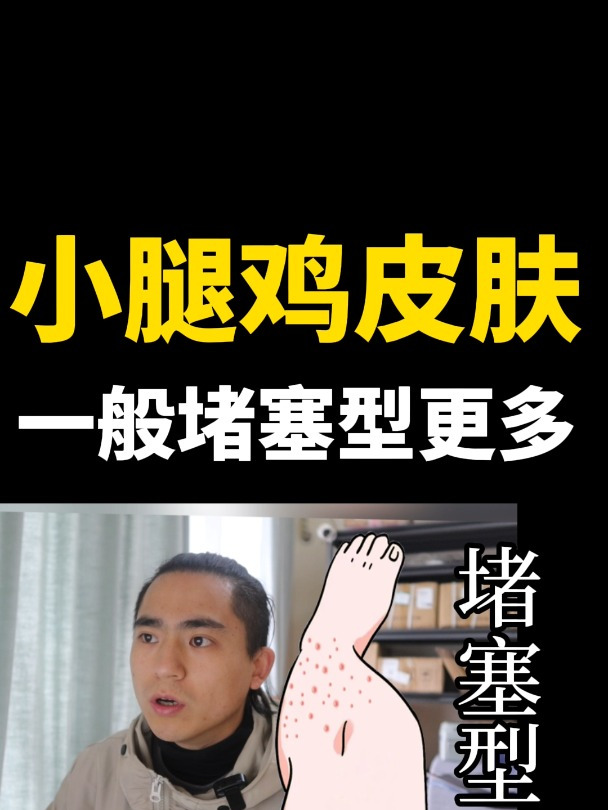 小腿鸡皮肤真是要了老命了!