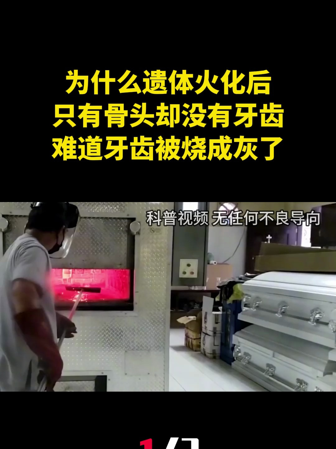 为什么遗体火化后,只有骨头却没有牙齿?难道牙齿被烧成灰了?