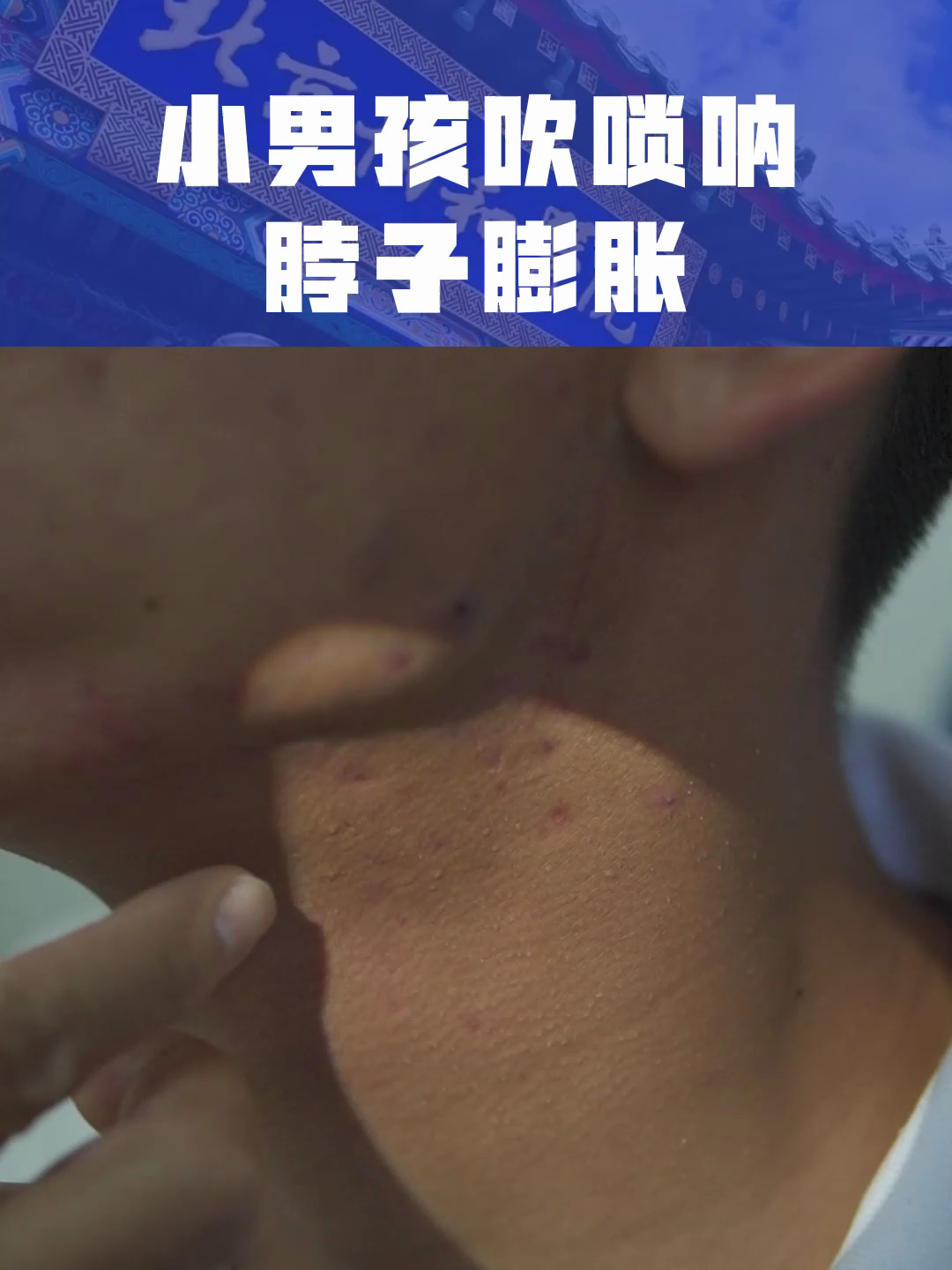小男孩吹唢呐 脖子膨胀