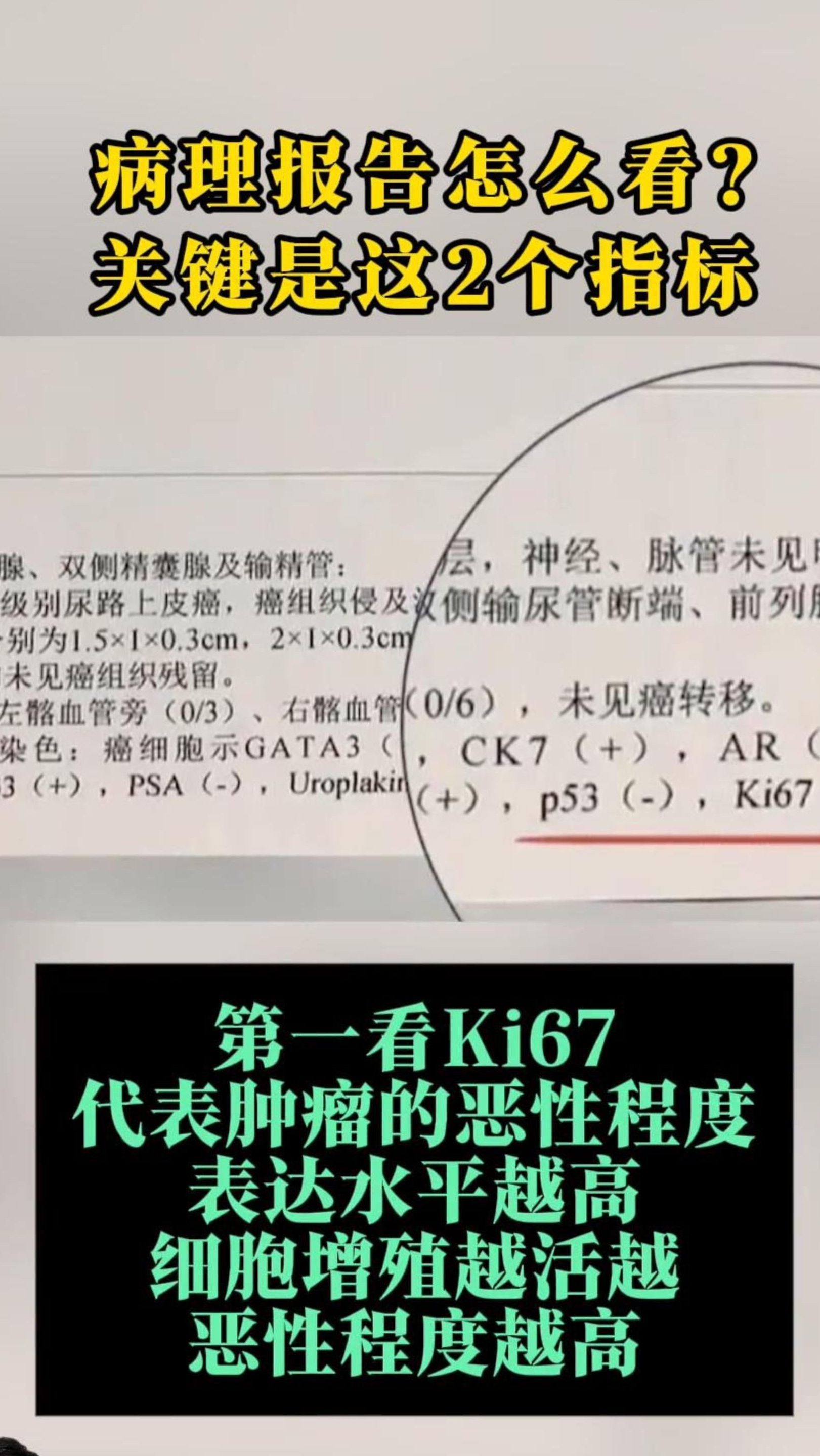 病理报告怎么看?