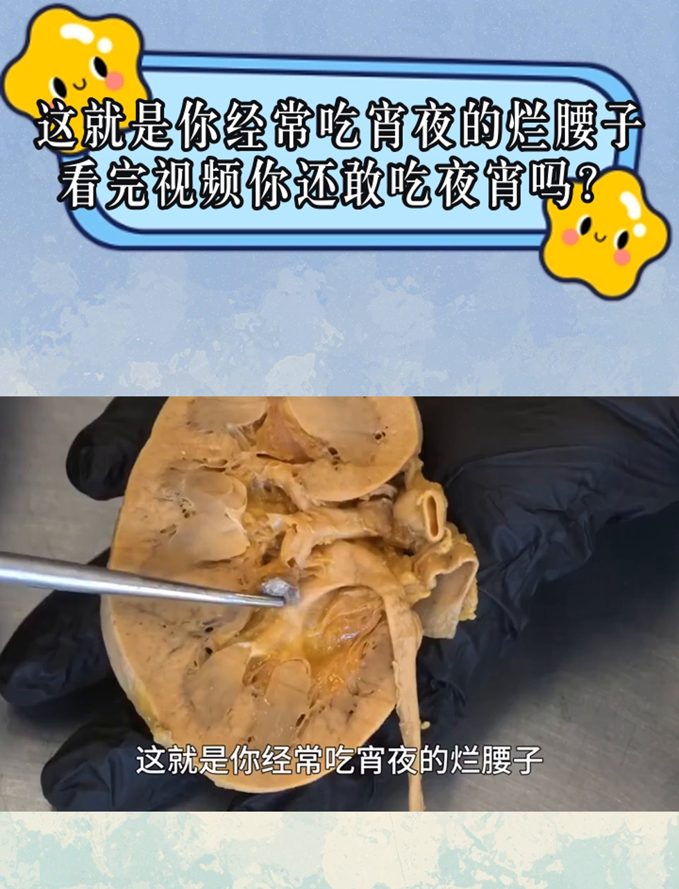 瞧这夜宵摊的脏腰子,看完视频你还敢吃吗?