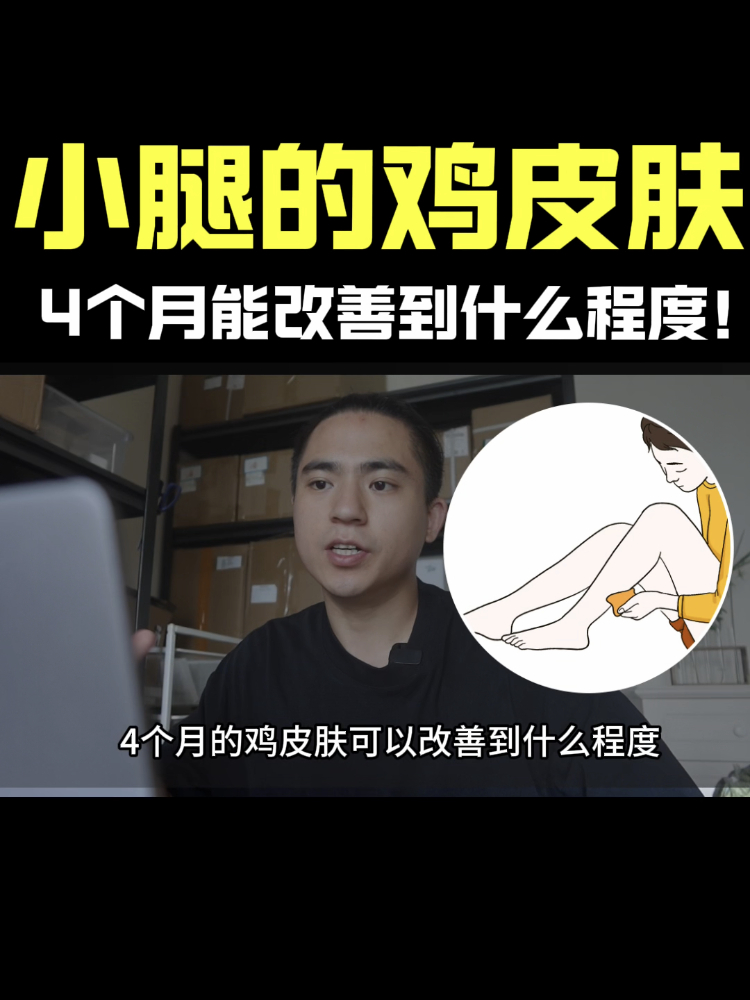 小腿上较常见的鸡皮肤!