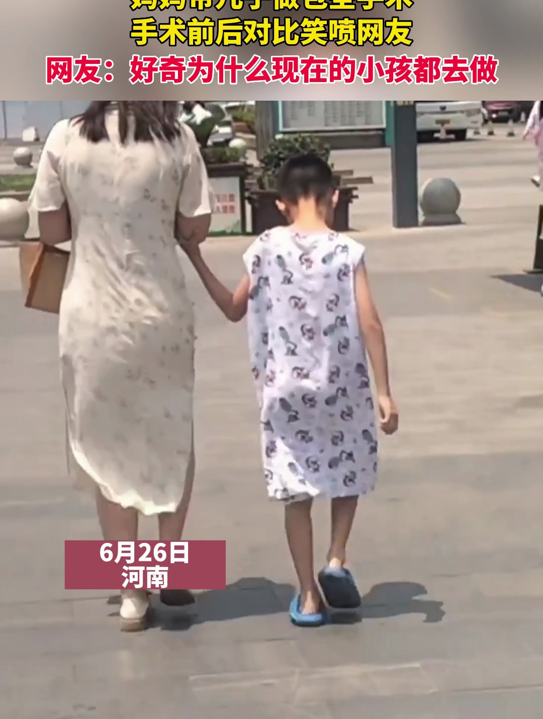 妈妈带儿子做包茎手术,手术前后对比笑喷网友